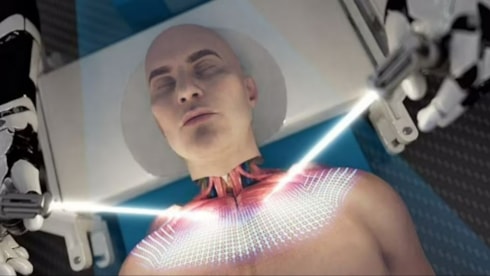 Dünyanın ilk kafa nakli sistemi büyük şaşkınlık yaratıyor