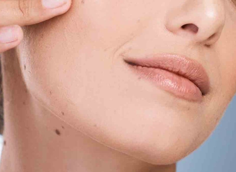 Astrolojiye göre vücudunuzdaki benlerin anlamı: Göz, göbek, boyun, alın, çene, yanak, sırt...