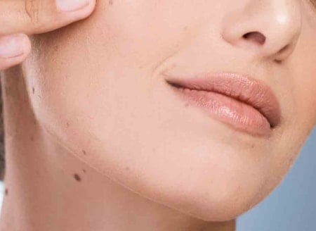 Astrolojiye göre vücudunuzdaki benlerin anlamı: Göz, göbek, boyun, alın, çene, yanak, sırt...