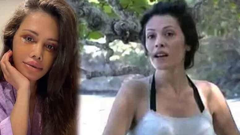 Survivor'ın eski yarışmacısı Didem Ceran 'yüz nakli' operasyonu geçirdi