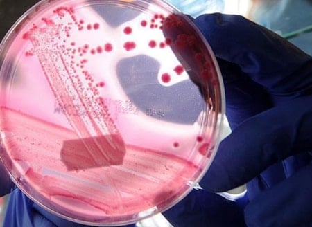 DSÖ'den kanser açıklaması: Dünya genelindeki vakaların 4'te 1'i önlenebilir