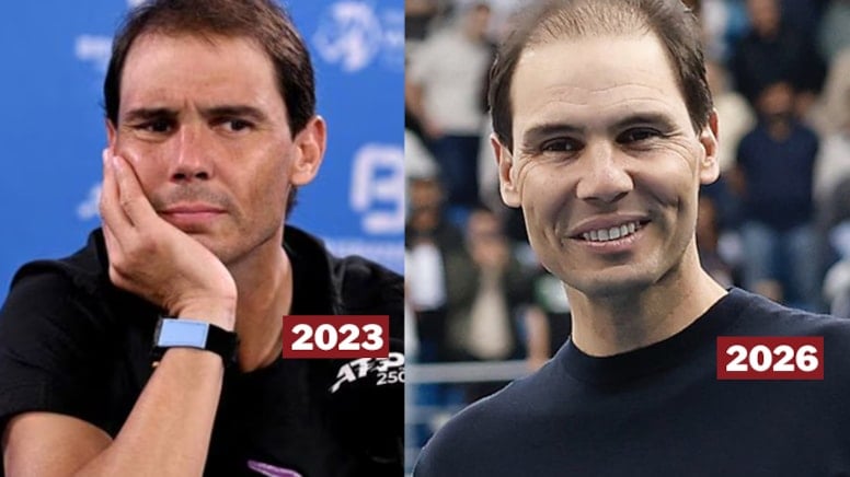 Rafael Nadal'ın 3 yıl içindeki değişimi hayrete düşürdü! 'Hastalığı mı var?'